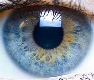 A photograph, depicting the appearance of a similar eye.
