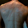 Prominent Scars On His Back