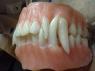 A general idea of what his teeth look like.